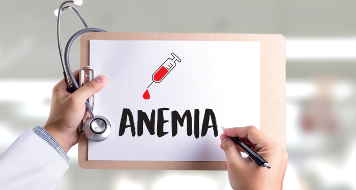 انيميا فقر الدم اسباب الانيميا وعلاجها 