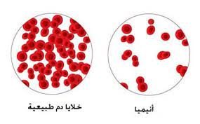 خلايا الدم الطبيعية مقارنة بالغير طبيعية 